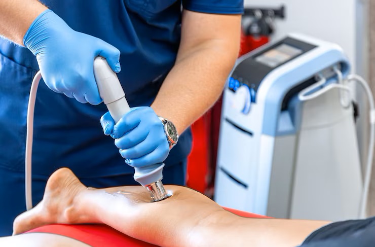 Varicose Veins Treatment Using Radiofrequency Technology